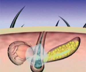 Hair Grow Max 2x1 a 20.021,60 HUF