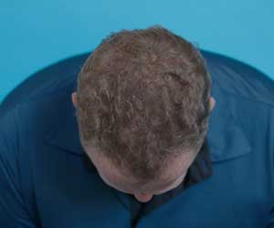 Hair Grow Max 2x1 a 248 LEU