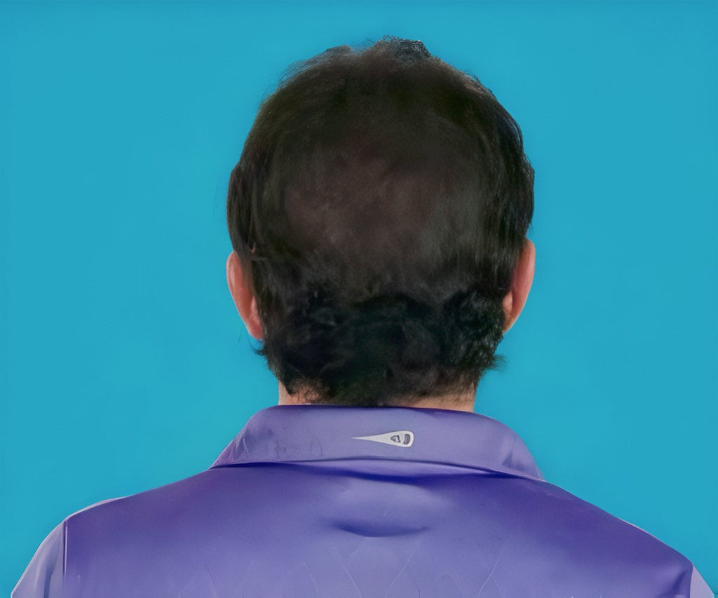 Hair Grow Max 2x1 a 20.021,60 HUF